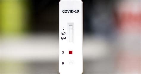 cdc dropping covid test requirement|CDC hasn't changed Covid guidelines yet: Here’s .